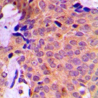 UBA2 Rabbit Polyclonal Antibody