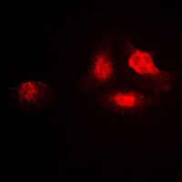 UBA2 Rabbit Polyclonal Antibody