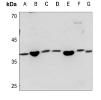 SAE1 Rabbit Polyclonal Antibody