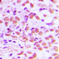 SAE1 Rabbit Polyclonal Antibody