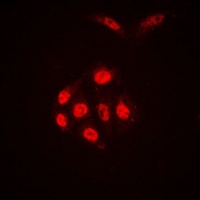 SAE1 Rabbit Polyclonal Antibody