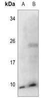 COX17 Rabbit Polyclonal Antibody