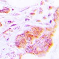 COX17 Rabbit Polyclonal Antibody