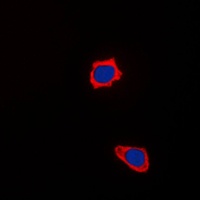 COX17 Rabbit Polyclonal Antibody
