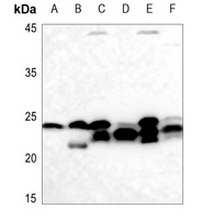 Cyclophilin F Rabbit Polyclonal Antibody
