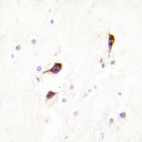 Cyclophilin F Rabbit Polyclonal Antibody