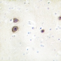 Renin Receptor Rabbit Polyclonal Antibody
