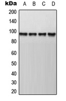 AKAP8 Rabbit Polyclonal Antibody