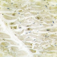 AKAP8 Rabbit Polyclonal Antibody