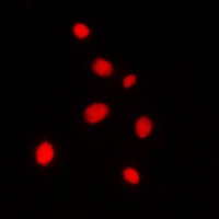 AKAP8 Rabbit Polyclonal Antibody