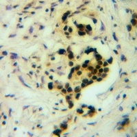 BCAS2 Rabbit Polyclonal Antibody
