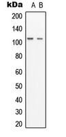 GCP3 Rabbit Polyclonal Antibody