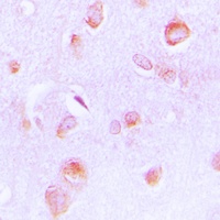 PECI Rabbit Polyclonal Antibody