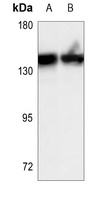 MERTK Rabbit Polyclonal Antibody