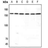 MERTK Rabbit Polyclonal Antibody