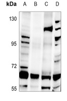 hnRNP Q Rabbit Polyclonal Antibody