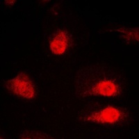 hnRNP Q Rabbit Polyclonal Antibody