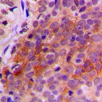 TXNRD2 Rabbit Polyclonal Antibody