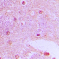 TAF6L Rabbit Polyclonal Antibody