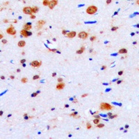 CUGBP1 Rabbit Polyclonal Antibody