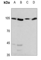 HSPH1 Rabbit Polyclonal Antibody