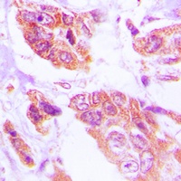 HSPH1 Rabbit Polyclonal Antibody