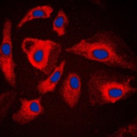 HSPH1 Rabbit Polyclonal Antibody