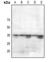 STARD10 Rabbit Polyclonal Antibody