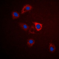 GPR75 Rabbit Polyclonal Antibody