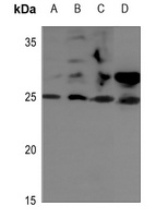 STMN2 Rabbit Polyclonal Antibody