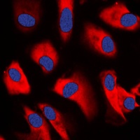 CDC37 Rabbit Polyclonal Antibody