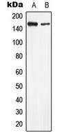 LMTK2 Rabbit Polyclonal Antibody