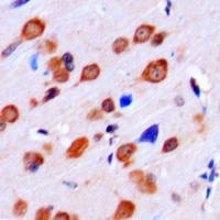 LMTK2 Rabbit Polyclonal Antibody