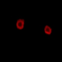 LMTK2 Rabbit Polyclonal Antibody