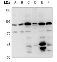 FASTKD2 Rabbit Polyclonal Antibody