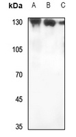 RAB3GAP1 Rabbit Polyclonal Antibody
