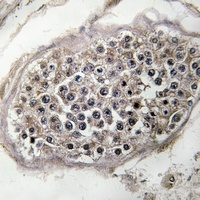 RAB3GAP1 Rabbit Polyclonal Antibody