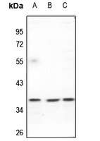 FAIM2 Rabbit Polyclonal Antibody