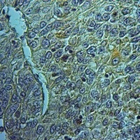 FAIM2 Rabbit Polyclonal Antibody