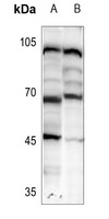 HIC2 Rabbit Polyclonal Antibody