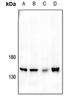 JIP3 Rabbit Polyclonal Antibody
