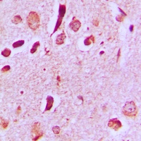 JIP3 Rabbit Polyclonal Antibody