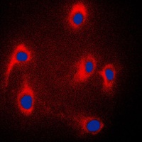 JIP3 Rabbit Polyclonal Antibody