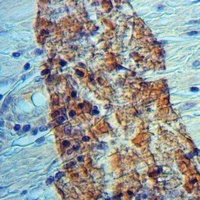 RGL1 Rabbit Polyclonal Antibody