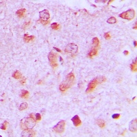 JIP2 Rabbit Polyclonal Antibody