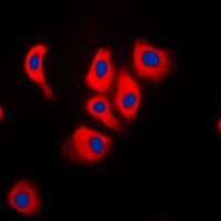 JIP2 Rabbit Polyclonal Antibody
