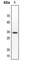 SMUG1 Rabbit Polyclonal Antibody