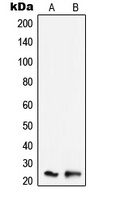 SCC-S2 Rabbit Polyclonal Antibody