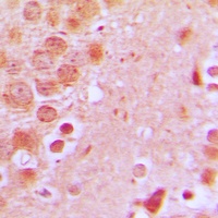 SCC-S2 Rabbit Polyclonal Antibody