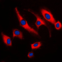 SCC-S2 Rabbit Polyclonal Antibody